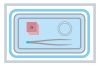 IVF MEDSET Blasenspülung Set 9906150, 1 Stück
