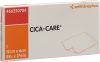 CICA-CARE Silikongel Verband 6 x 12 cm
