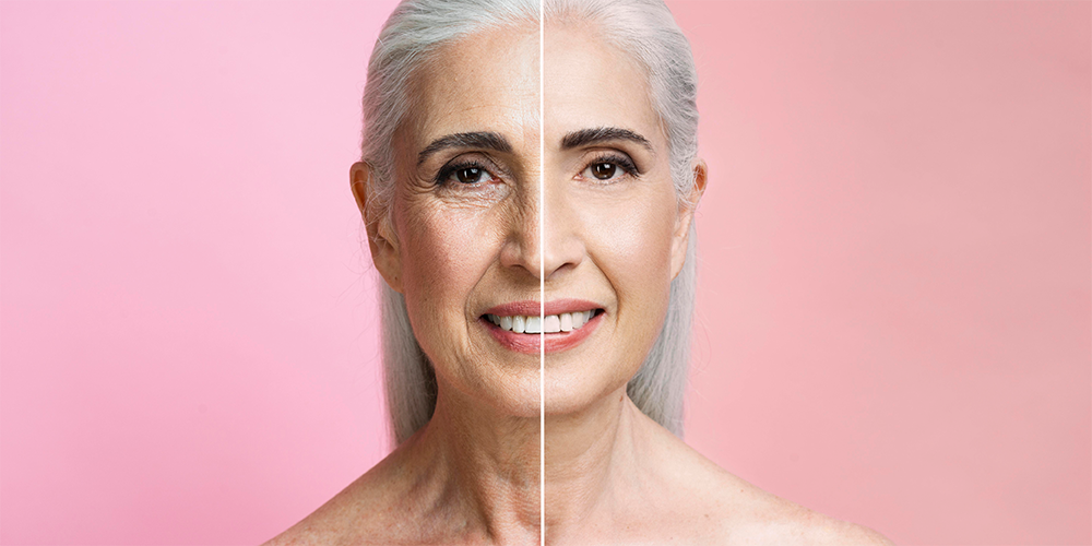 Anti Aging : comment influencer le vieillissement de la peau ?