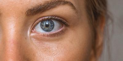Strahlende Augen: Ursachen und Lösungen für Augenringe, Krähenfüsse & Co.